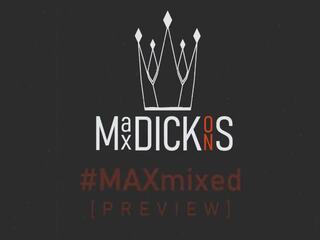 Max Dickons - Kinky Mixed Compilation, HD adult movie b3